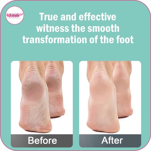 ملصقات مضادة لحماية القدم عند ارتداء الكعب 5 شرائط