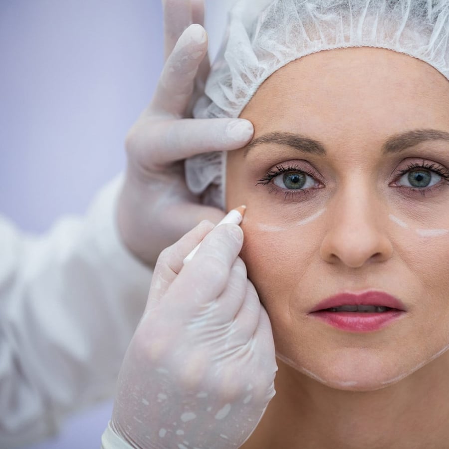 Botox areas / around the eye