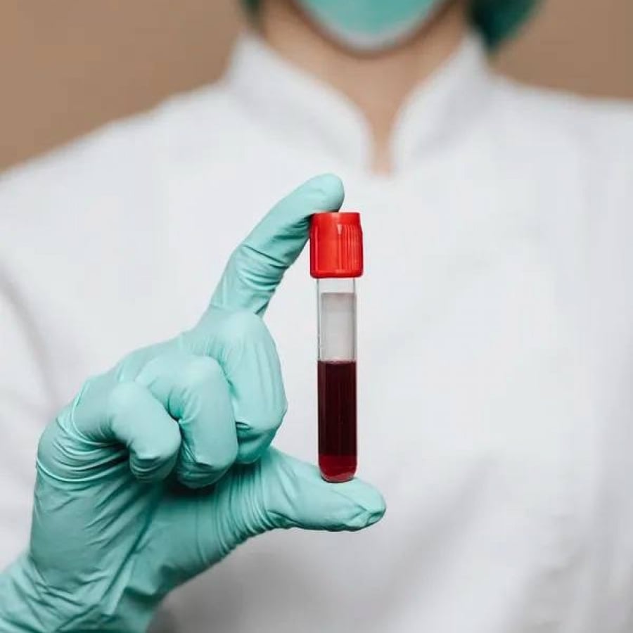 Public health analysis (blood picture - iron store - iron)