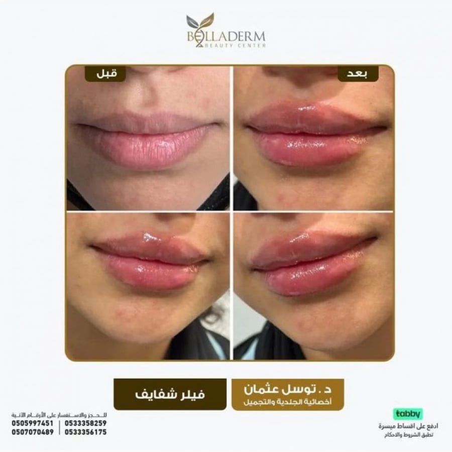 Book a consultation with the consultant Dr. Tasl Osman