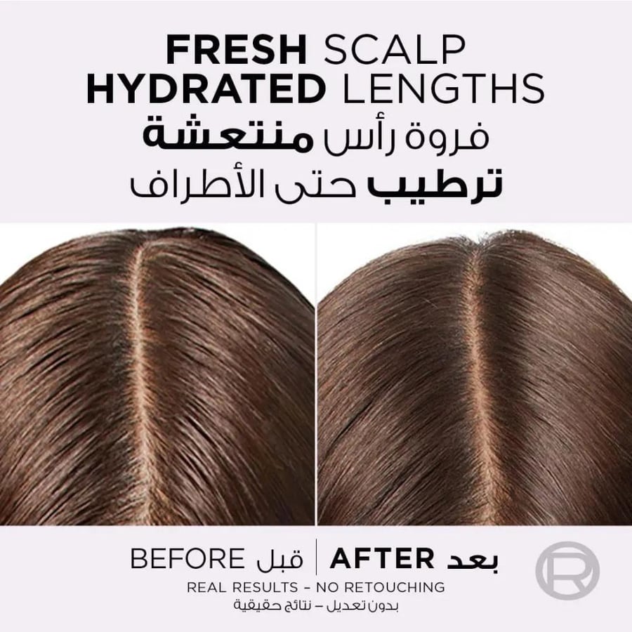L'Oreal Paris شامبو إلفيف هيالورون بيور من لوريال باريس 400 مل