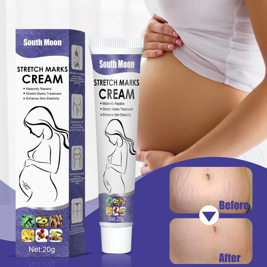كريم ساوث مون للعناية بمظهر علامات التمدد 20 جم – South Moon Stretch Marks Cream
