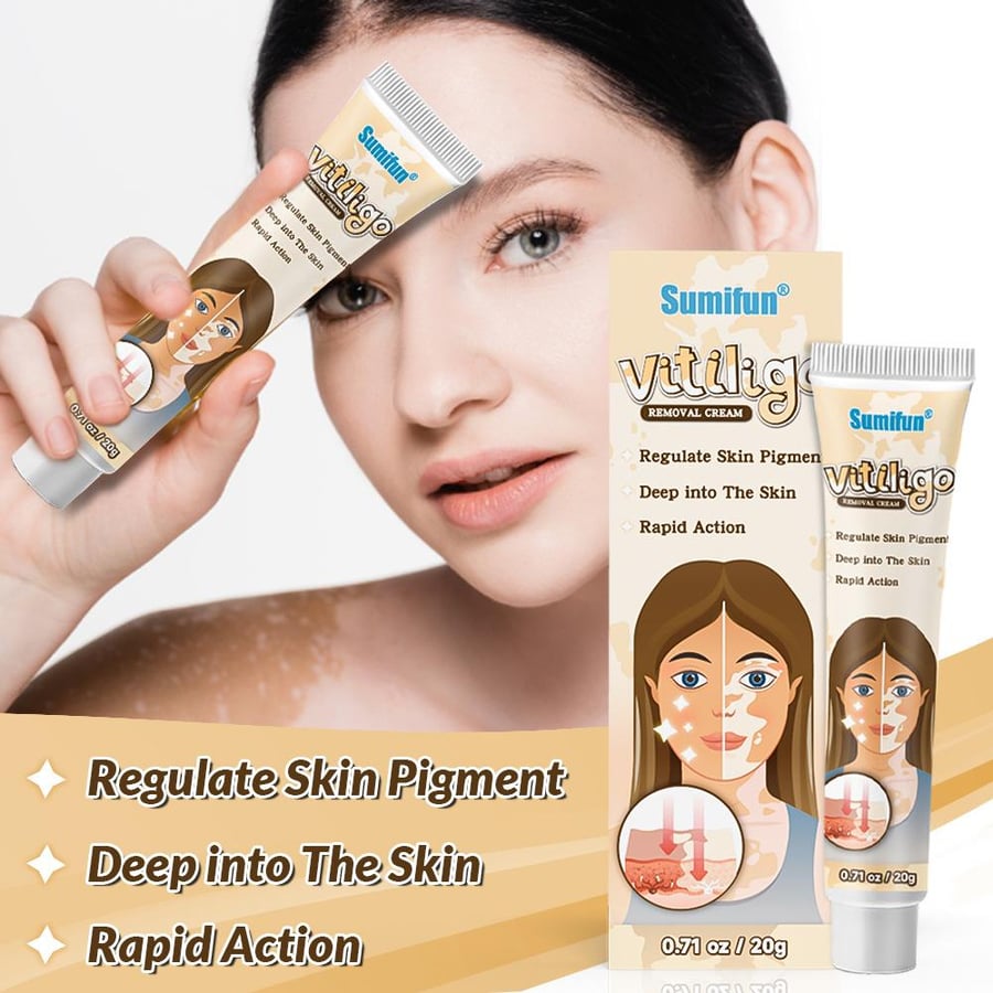 Sumifun advanced cream for vitiligo care and skin tone evening (20 grams)