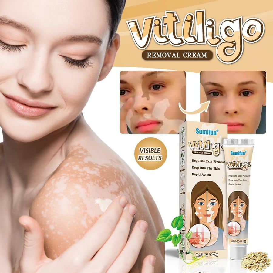 Sumifun advanced cream for vitiligo care and skin tone evening (20 grams)