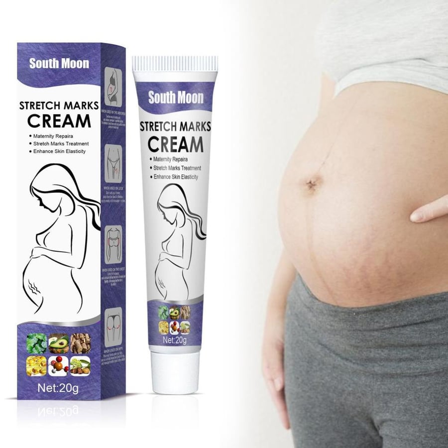 كريم ساوث مون للعناية بمظهر علامات التمدد 20 جم – South Moon Stretch Marks Cream