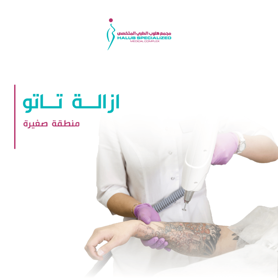 ازالة تاتو " الوشم " منطقة صغيرة