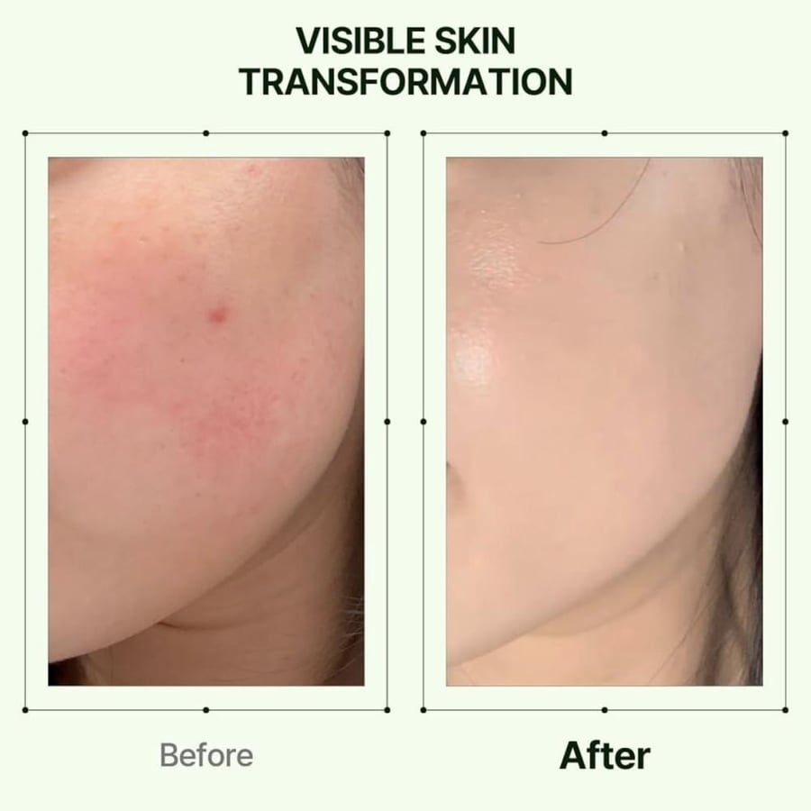 أوريان – مرطب الشيح زيرو فيلم 60مل Orien - Mugwort Zero Film Moisturizer