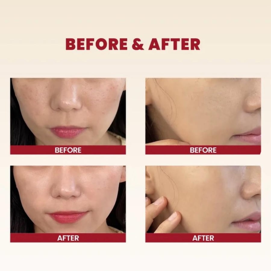 ‏KSECRET - SEOUL 1988 Cream : Snail Mucin 93% + Rice كريم: 93% مخاط الحلزون + الأرز