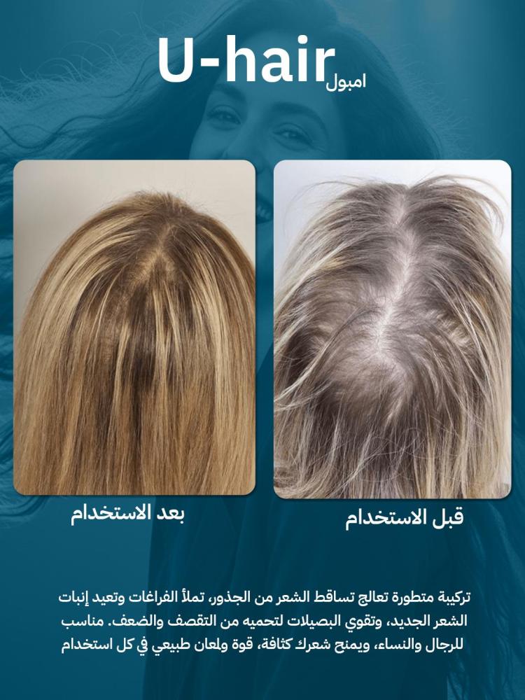 عبوتين يو هير امبول U Hair Ampoule | أفضل علاج لتساقط الشعر وتكثيف الشعر من الجذور