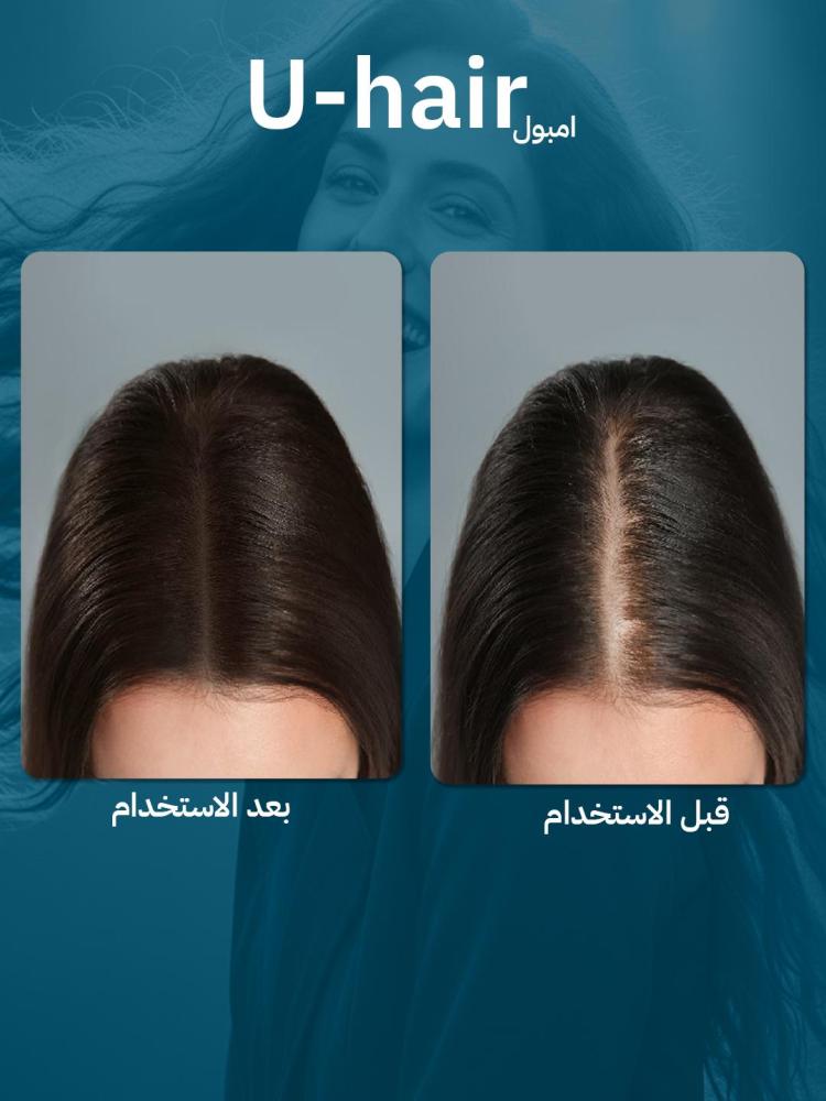 عبوتين يو هير امبول U Hair Ampoule | أفضل علاج لتساقط الشعر وتكثيف الشعر من الجذور