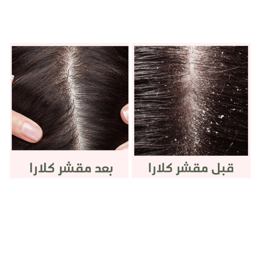 كلارا سكراب مقشر للفروة