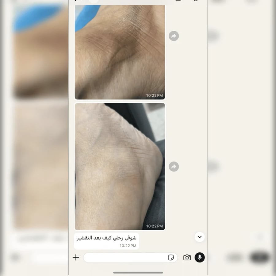 بكج فلورز التايلندي | روتين 4 خطوات للعناية بمظهر تفاوت لون الجسم