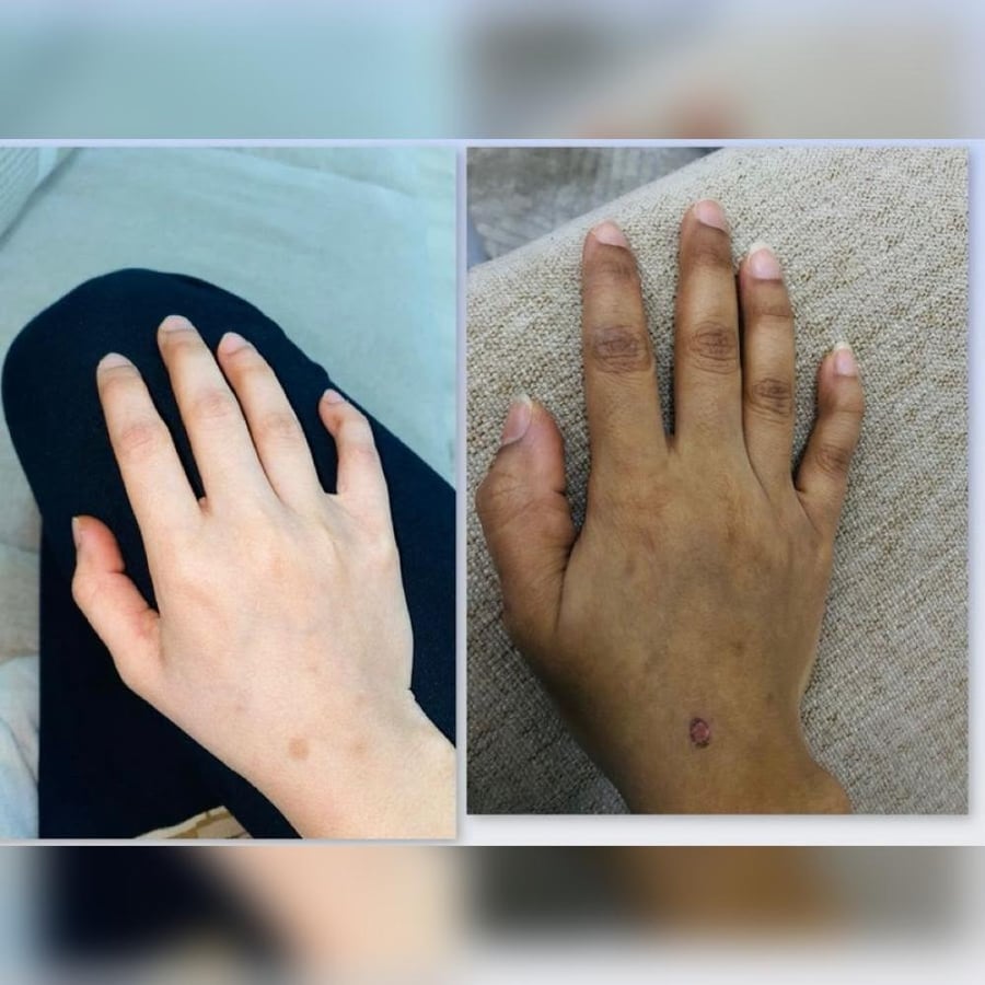 بكج فلورز التايلندي | روتين 4 خطوات للعناية بمظهر تفاوت لون الجسم