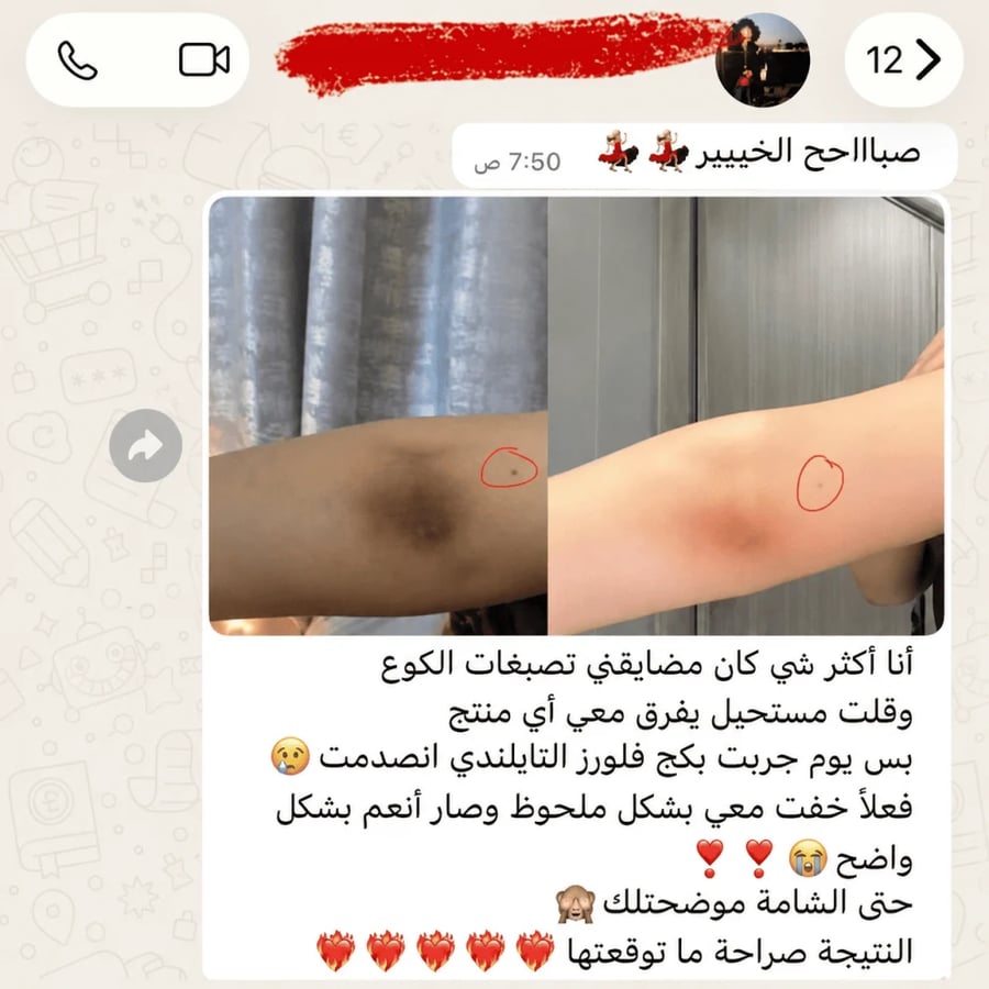 بكج فلورز التايلندي | روتين 4 خطوات للعناية بمظهر تفاوت لون الجسم