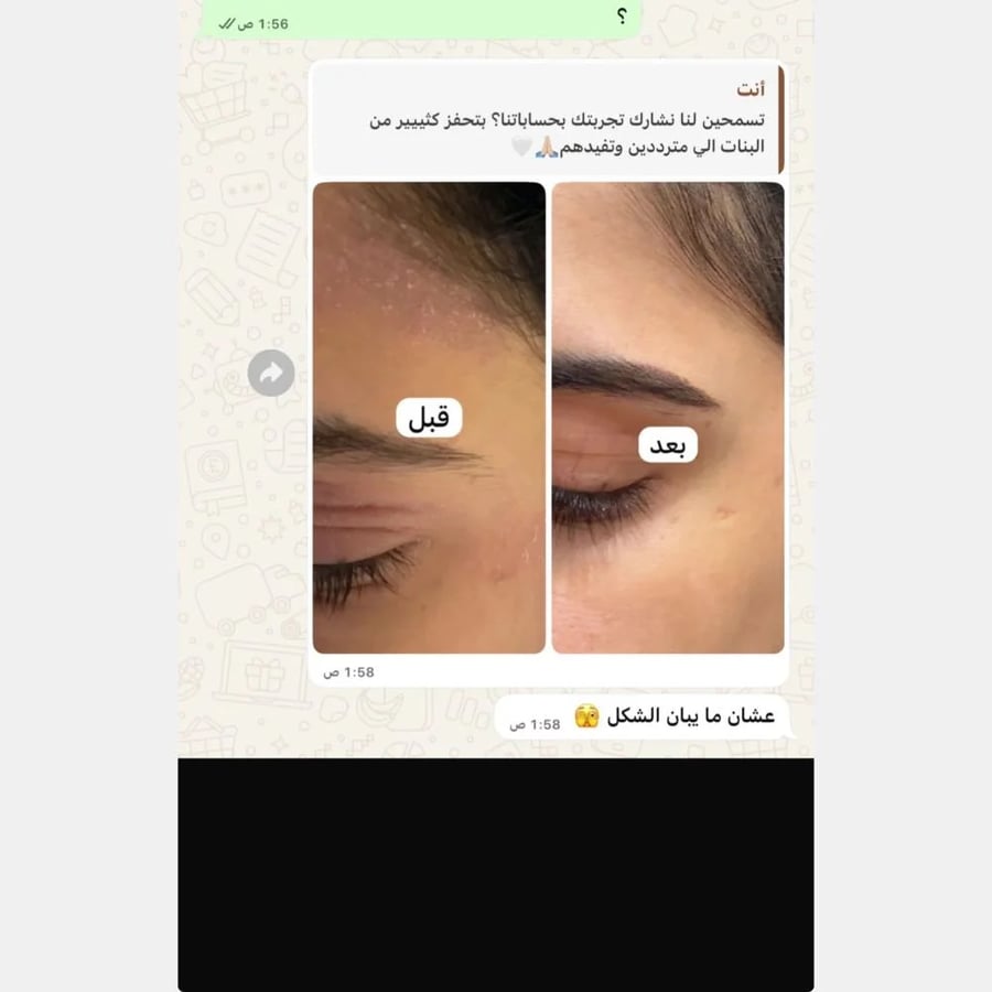 بكج فلورز التايلندي | روتين 4 خطوات للعناية بمظهر تفاوت لون الجسم