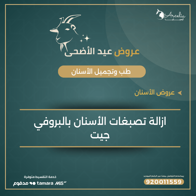 إزالة التصبغات الأسنان بالبروفي جيت