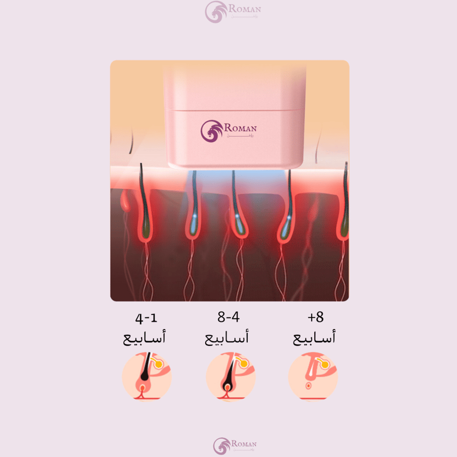 عدسة ازالة شعر ليزر T16
