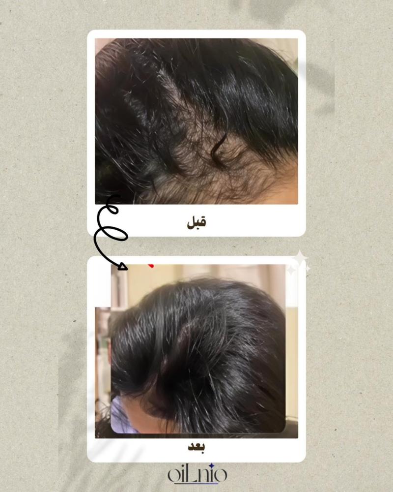 لشعر كثيف و طويل