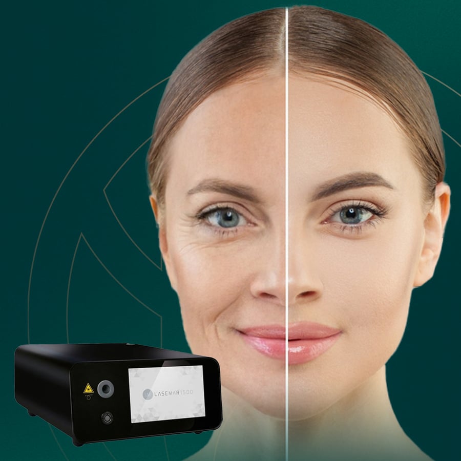 Non-surgical facial tightening