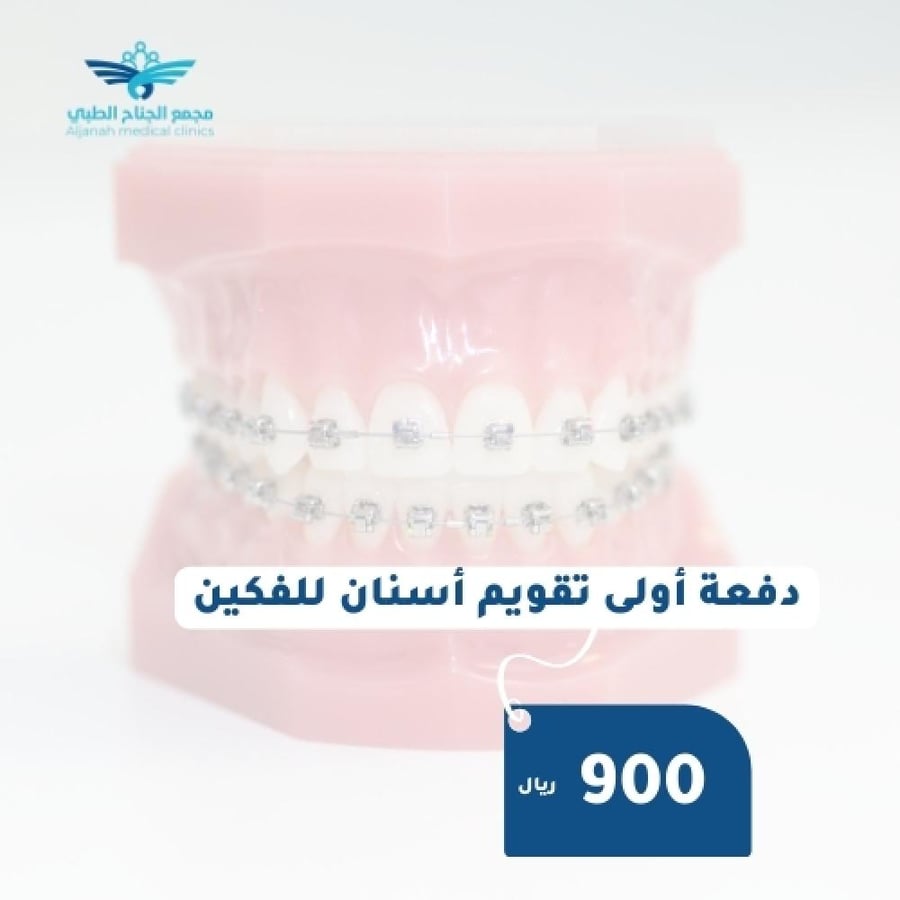 دفعة أولى تقويم أسنان للفكين
