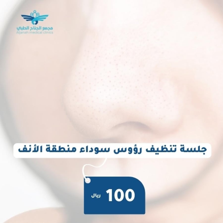 جلسة تنظيف رؤوس سوداء منطقة الانف