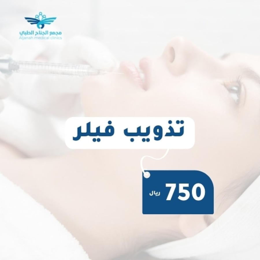تذويب فيلر