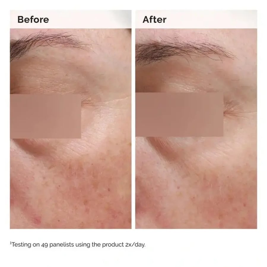 The Ordinary Niacinamide 5% Face & Body Emulsion 100ml