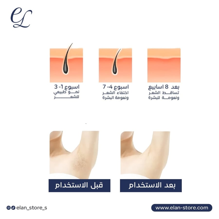 جهاز إزالة الشعر IPL المنزلي