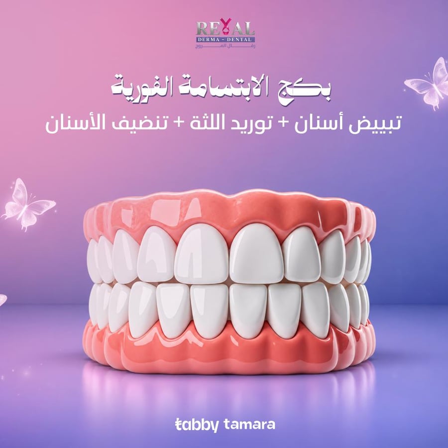 تنظيف وتبييض الأسنان وتوريد اللثة بالليزر
