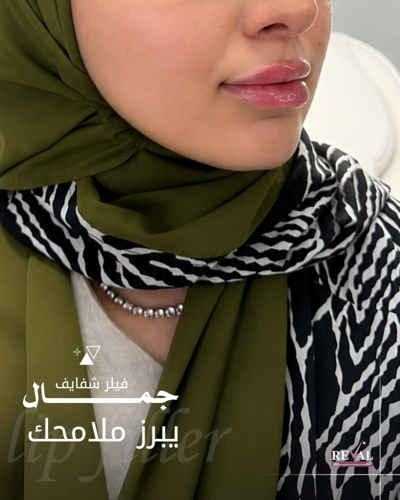 فيلر 1 مل للأنواع (اوبرا، بوش، ايلين)