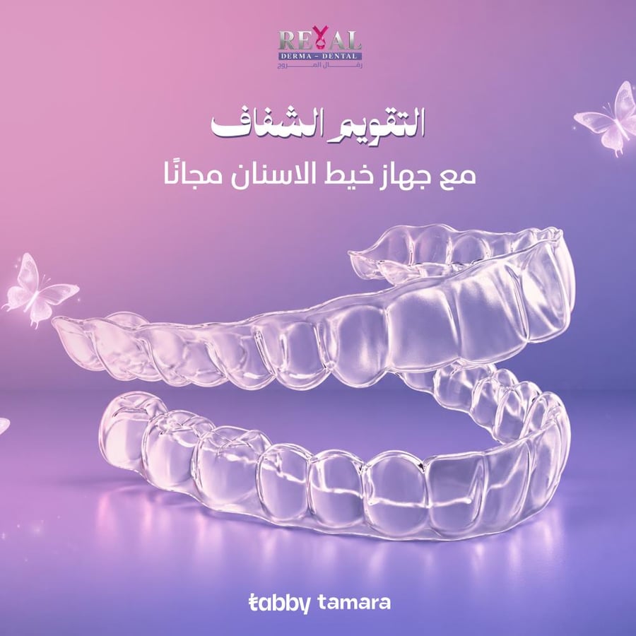 تقويم الاسنان الشفاف بالتقسيط