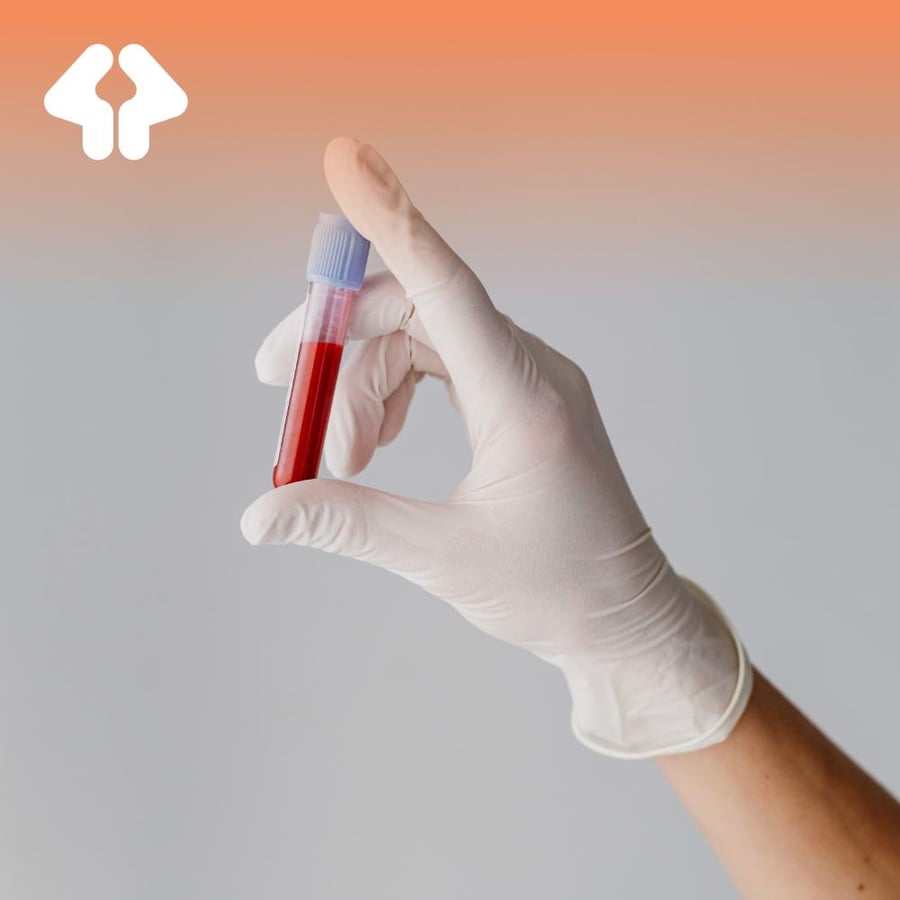 تحليل هرمون الكورتيزول (هرمون التوتر) - Cortisol Test