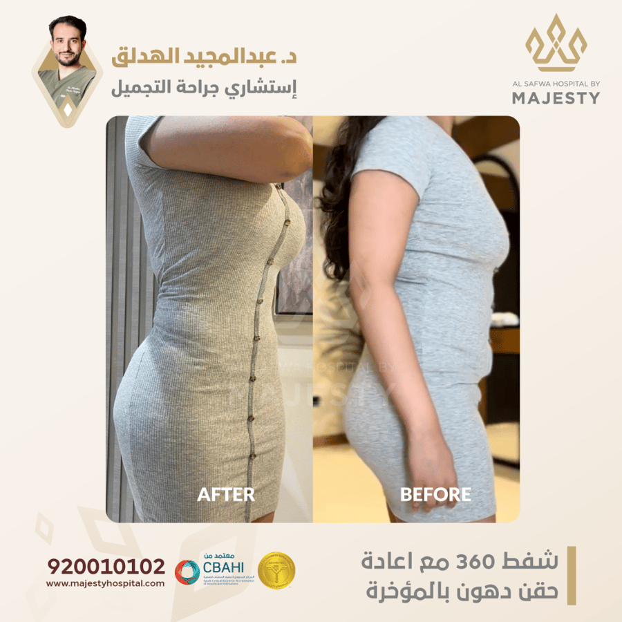 استشارة مع د. عبدالمجيد الهدلق test
