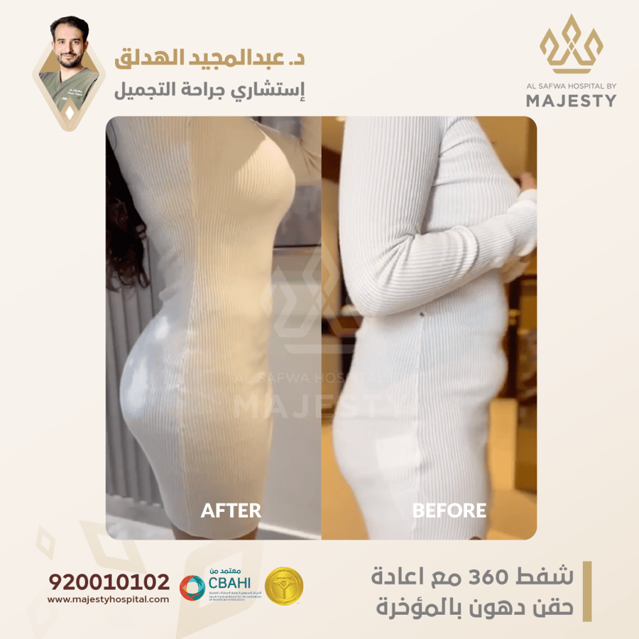 استشارة مع د. عبدالمجيد الهدلق
