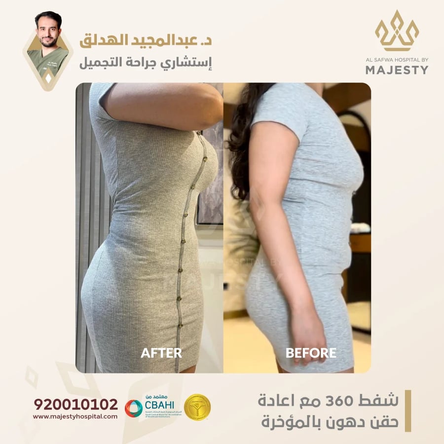 استشارة مع د. عبدالمجيد الهدلق
