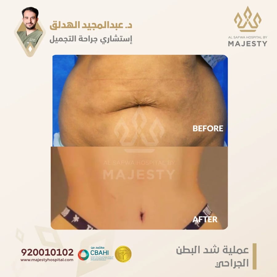 استشارة مع د. عبدالمجيد الهدلق