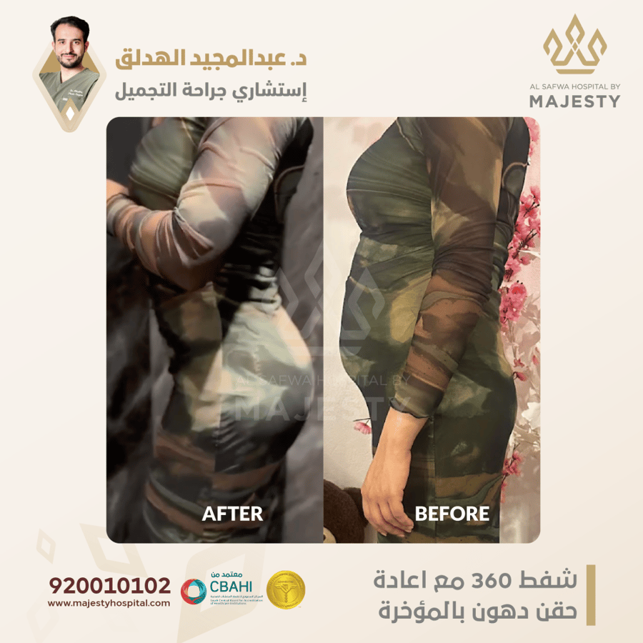 استشارة مع د. عبدالمجيد الهدلق