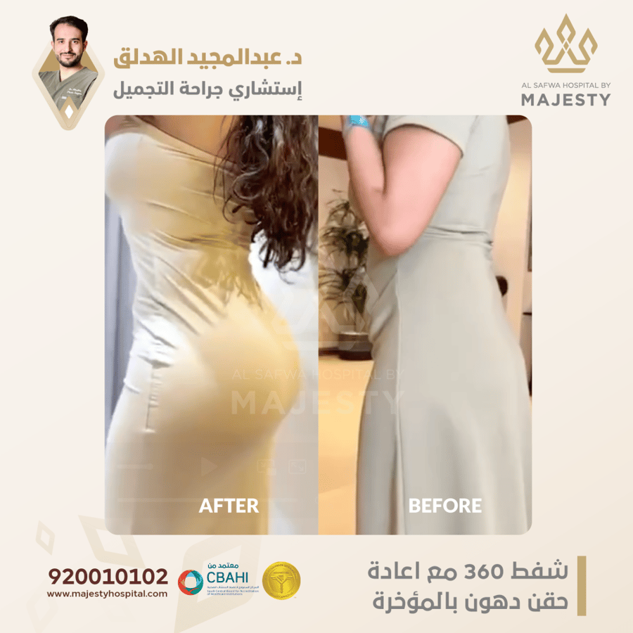 استشارة مع د. عبدالمجيد الهدلق