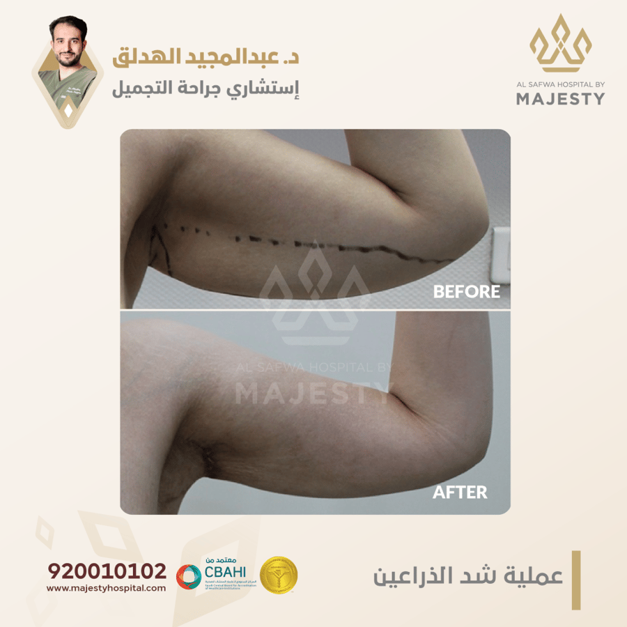 استشارة مع د. عبدالمجيد الهدلق