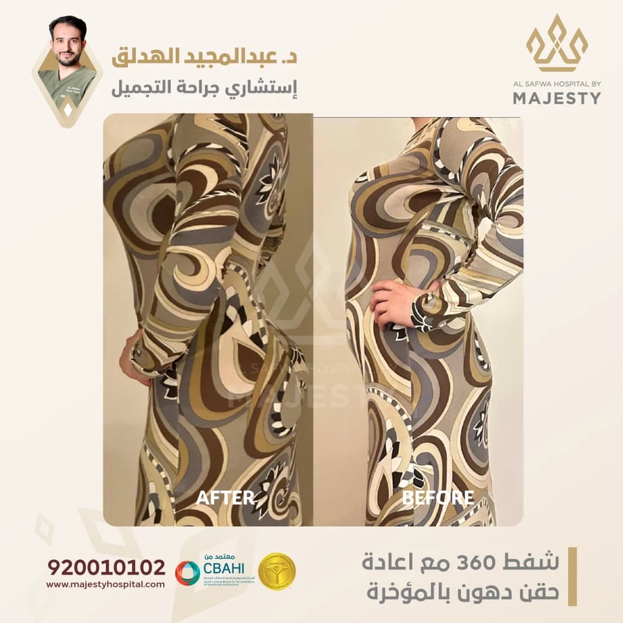 استشارة مع د. عبدالمجيد الهدلق
