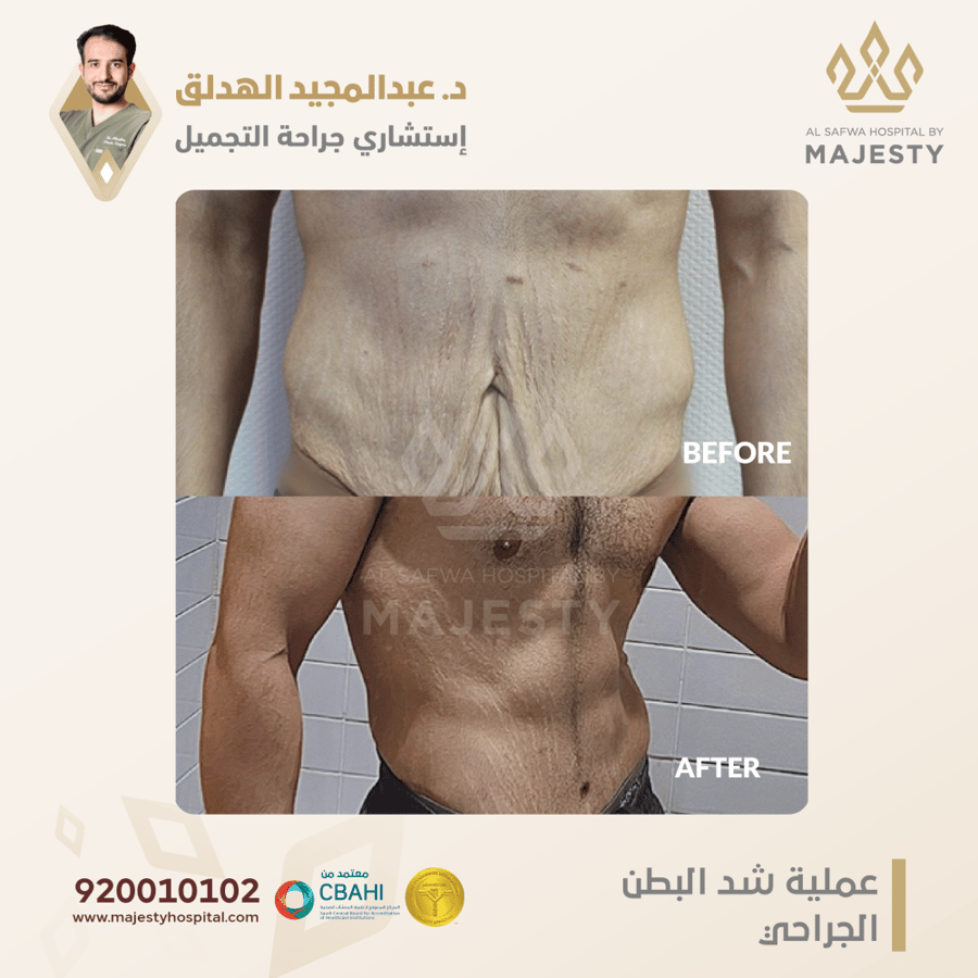 استشارة مع د. عبدالمجيد الهدلق test