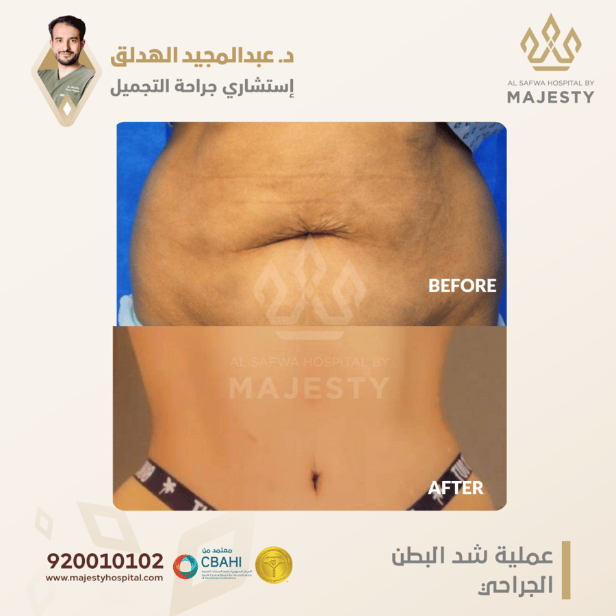 استشارة مع د. عبدالمجيد الهدلق test