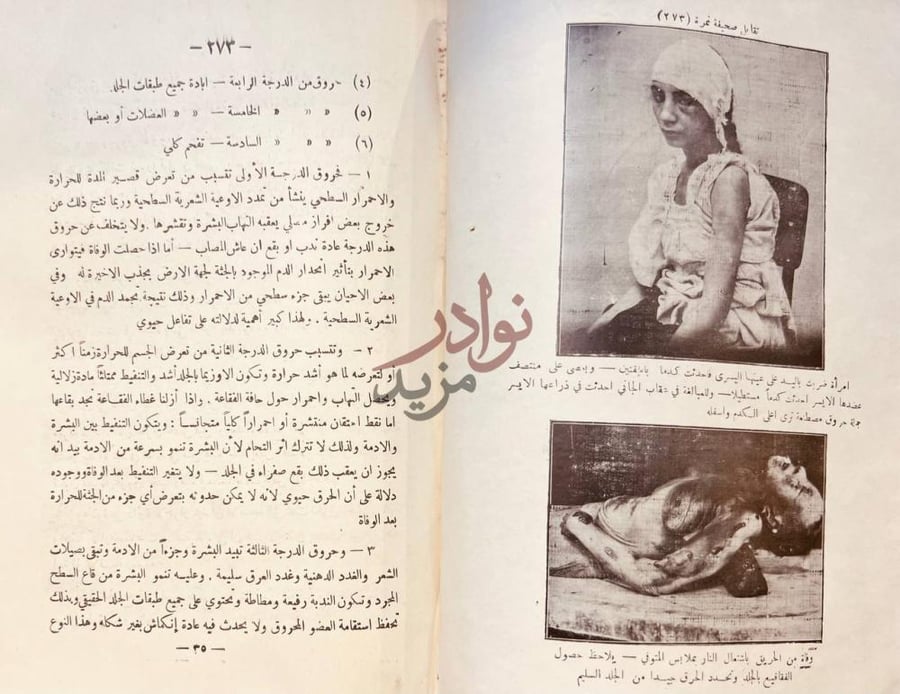 صفحة داخلية كتاب الطب الشرعي في مصر فيه صور