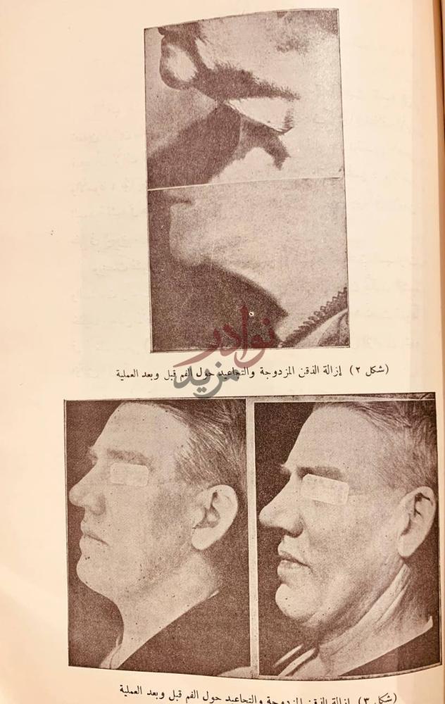 صفحة داخلية كتاب التقدم الحديث في جراحة التجميل