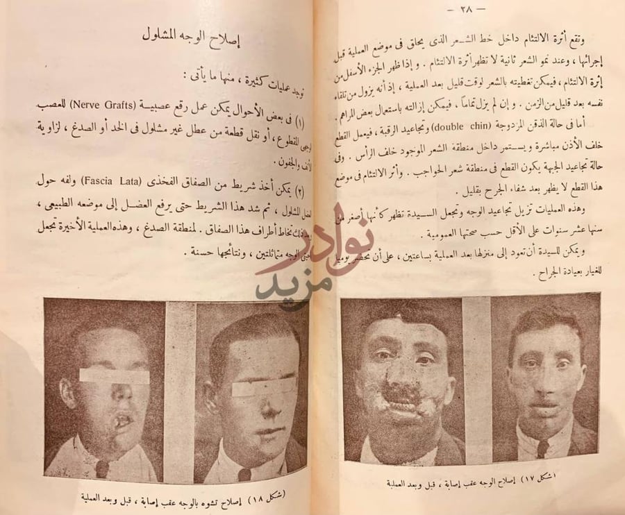 صفحة داخلية كتاب التقدم الحديث في جراحة التجميل