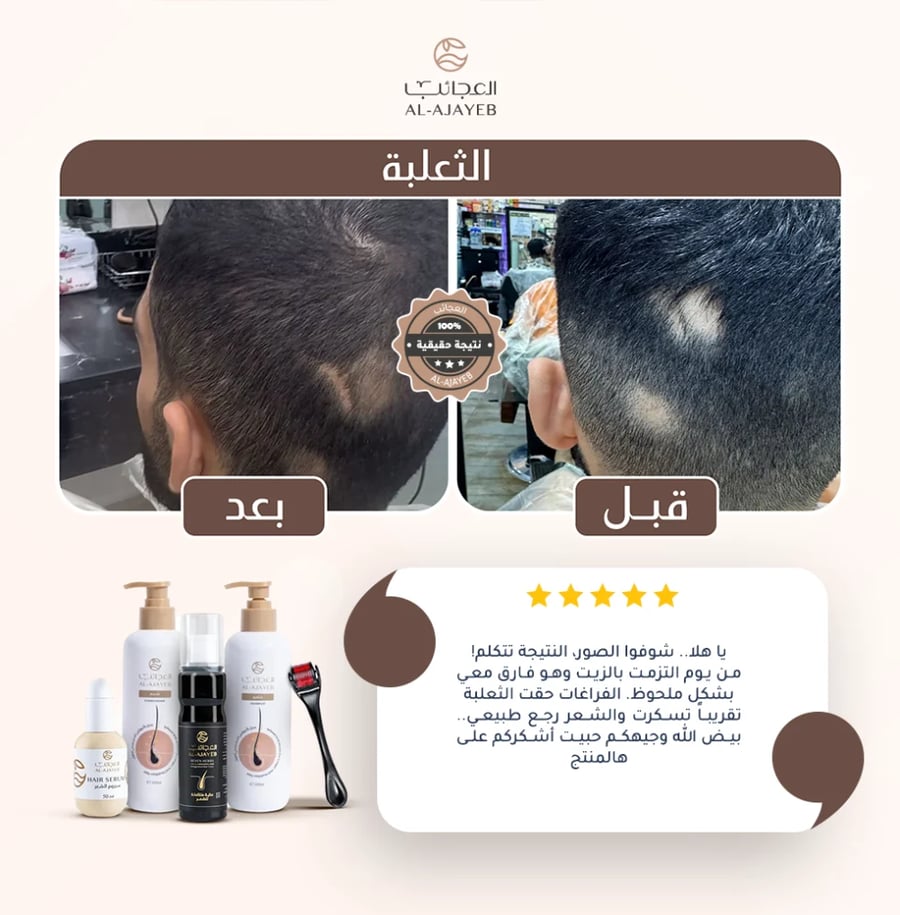 زيت الأعشاب السبعة 60مل