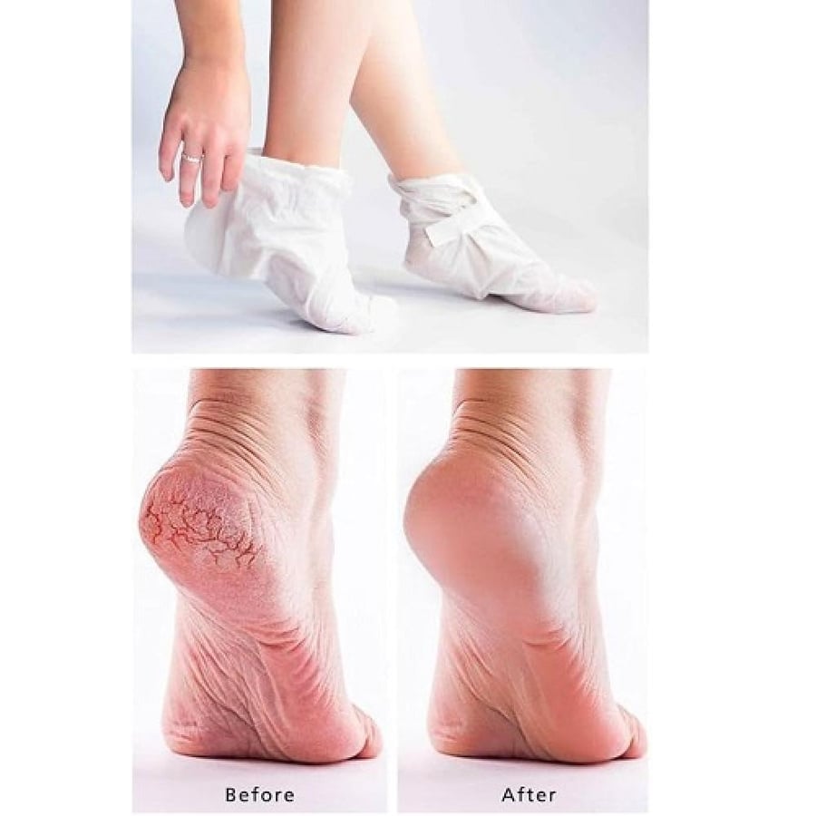 ميديهيل قناع بارافين للقدم يرطب ويقشر