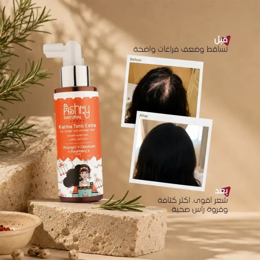 سبراي كارما تونيك اكسترا لمنع تساقط الشعر.