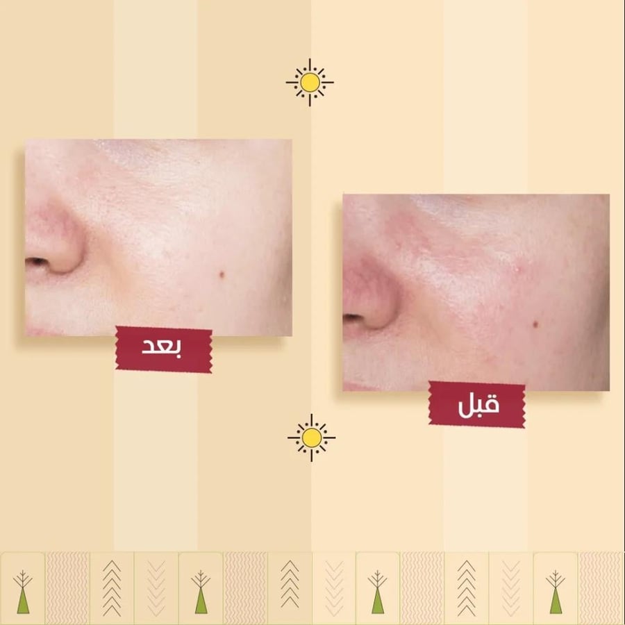 غسول الوجه بالجزر من أشري ناتشورال | غسول للبشرة الدهنية وحب الشباب