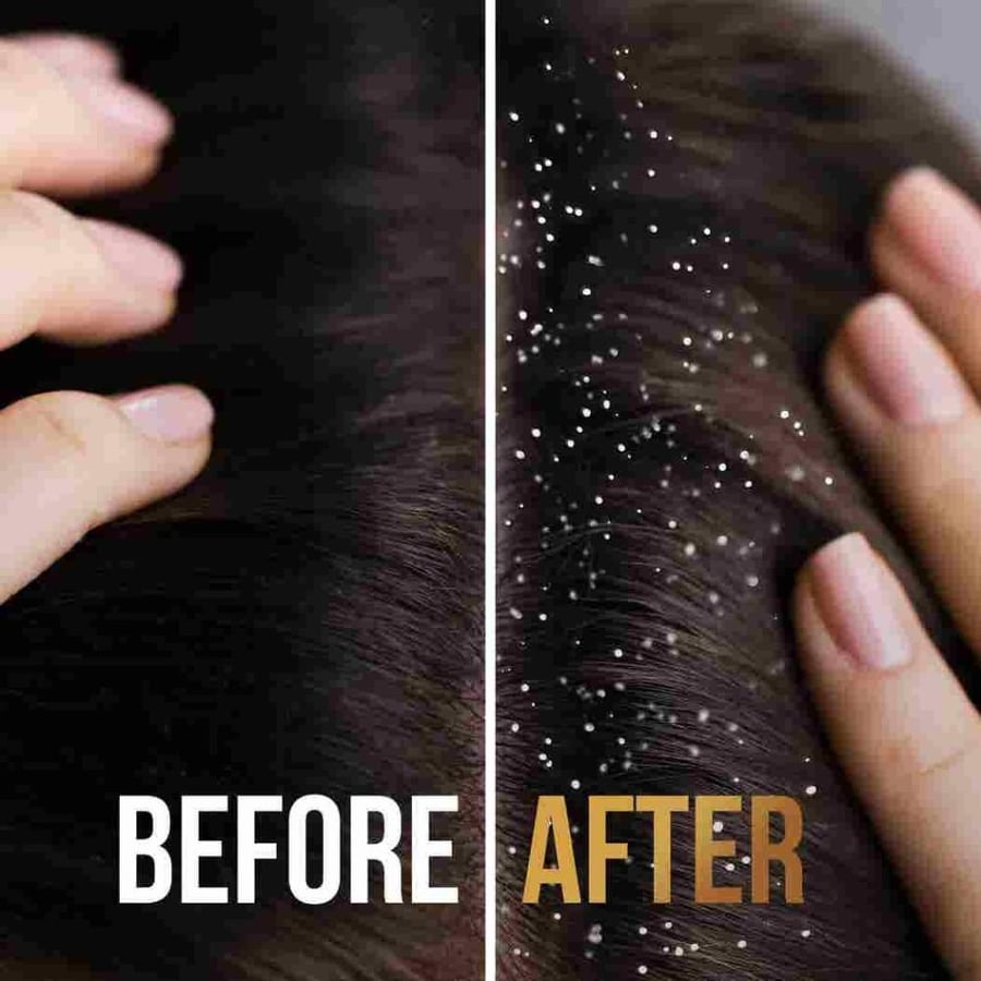 Pantene Hair Shampoo 400 ml Anti-Dandruff 2 in 1 11001446
